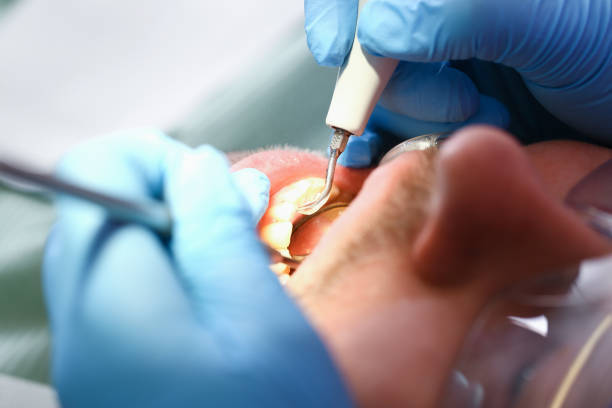 Best Urgent Dental Care for Toothache in St James, NC