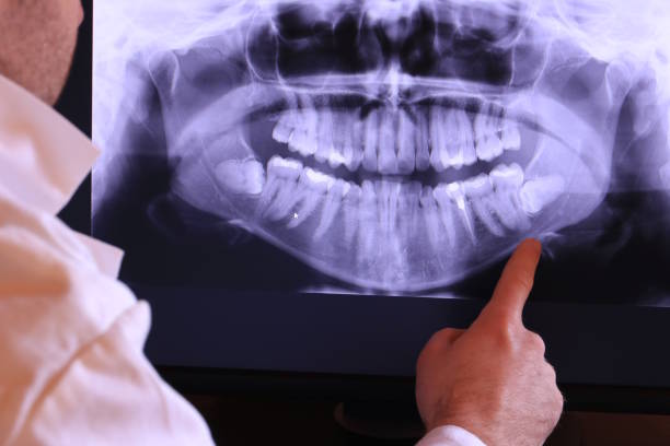 Best Broken or Cracked Tooth Emergency Dentist in St James, NC