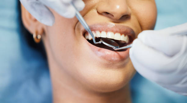 Best Broken or Cracked Tooth Emergency Dentist in St James, NC