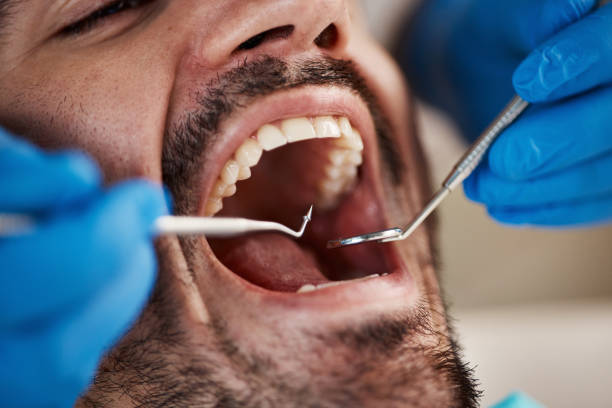 Best Weekend Emergency Dentist in St James, NC