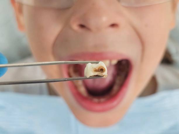 Best Emergency Dental Services for Seniors in St James, NC